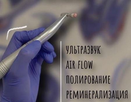 Профессиональная чистка зубов